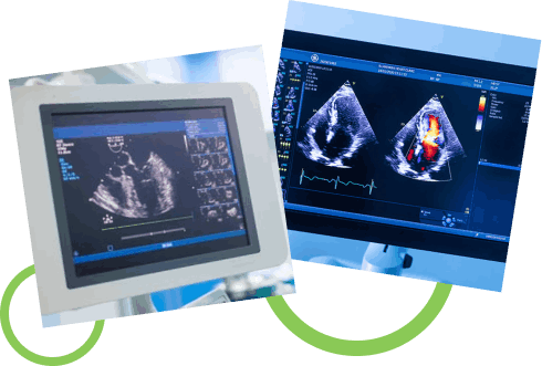 How Does the Test Work?