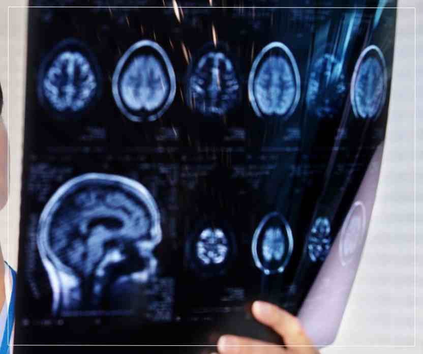 Diseases Treated by a Neurology Doctor in Naktala