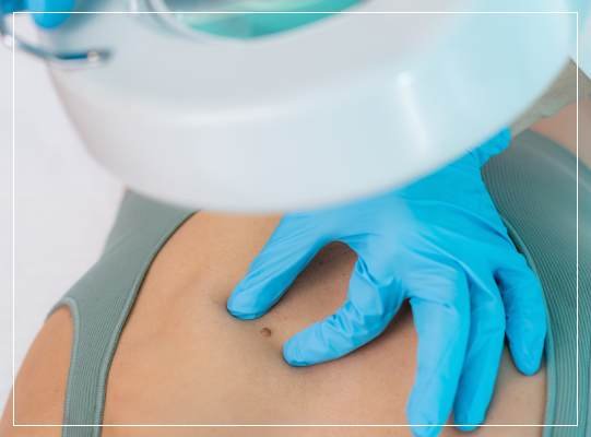 Biopsy Services: Precision in Diagnosis