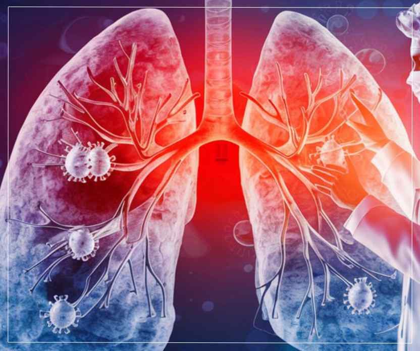 Diseases Treated by a Lung Specialist in Kolkata