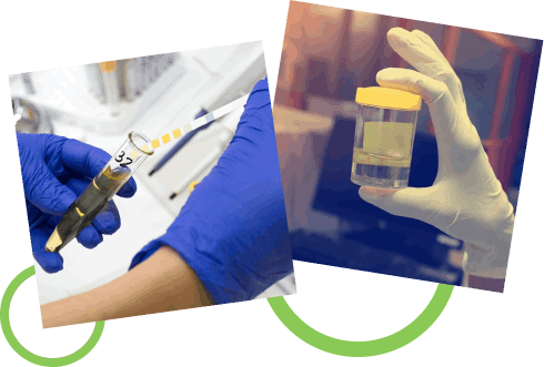 How Does the Uroflowmetry Test in Naktala Work?