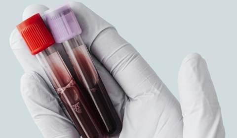 Thyroid Profile Extension Package