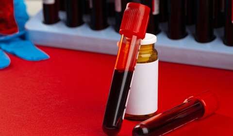 Thyroid Profile Smart Package