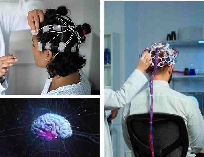 Why Choose Sugarline Health Care for Your EEG? | Sugarline Healthcare 